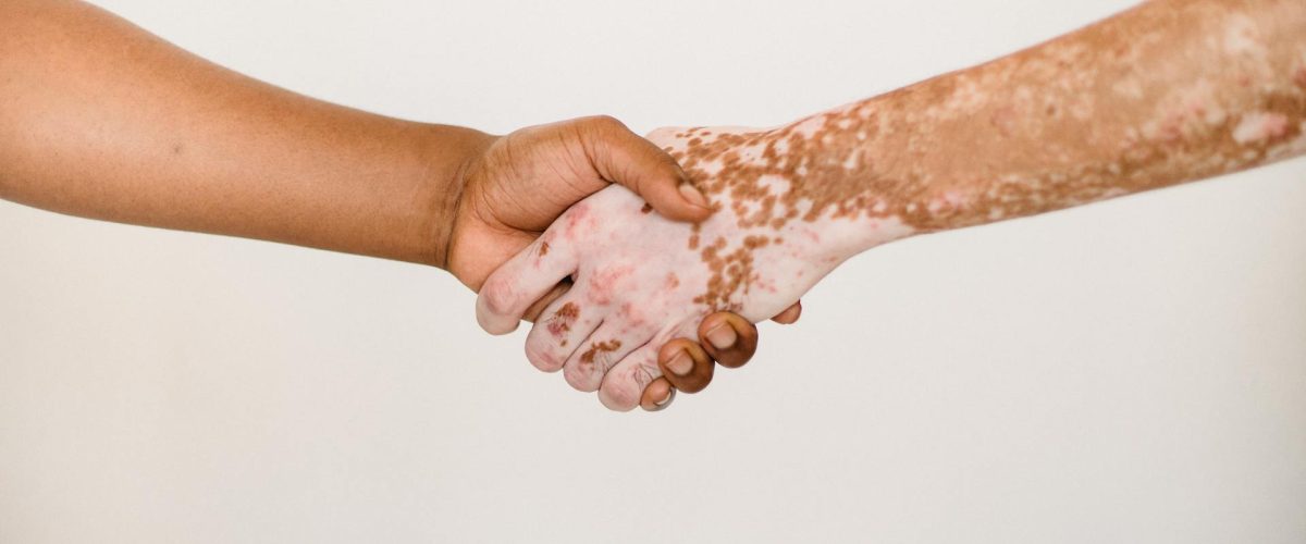 Weldco Heavy Industries Ltd. achieves significant gains through unity and support